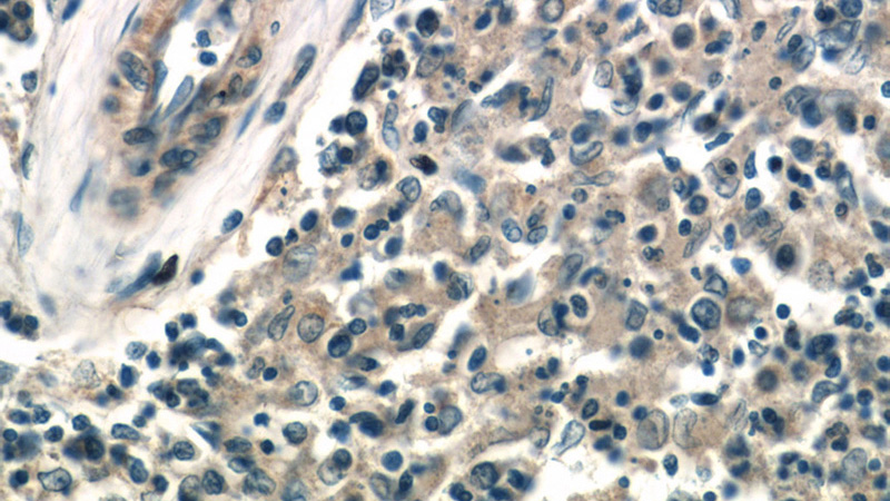 Immunohistochemistry of paraffin-embedded human spleen tissue slide using Catalog No:107687(ACOXL Antibody) at dilution of 1:50 (under 40x lens)