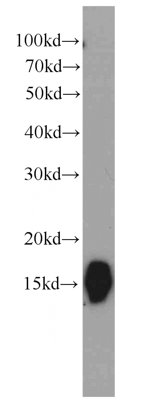 mouse kidney tissue were subjected to SDS PAGE followed by western blot with Catalog No:109322(CISD2 antibody) at dilution of 1:1000