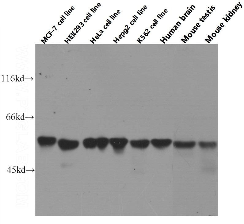 Western blot analysis of PK-M2-specific in various tissues and cell lines using Proteintech antibody Catalog No:107474 at dilution of 1:1000