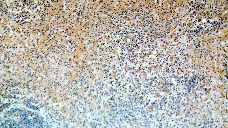 Immunohistochemical of paraffin-embedded human spleen using Catalog No:115695(STAT6 antibody) at dilution of 1:50 (under 10x lens)