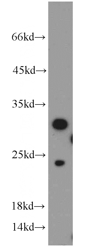 Jurkat cells were subjected to SDS PAGE followed by western blot with Catalog No:111367(HIST1H1C antibody) at dilution of 1:500
