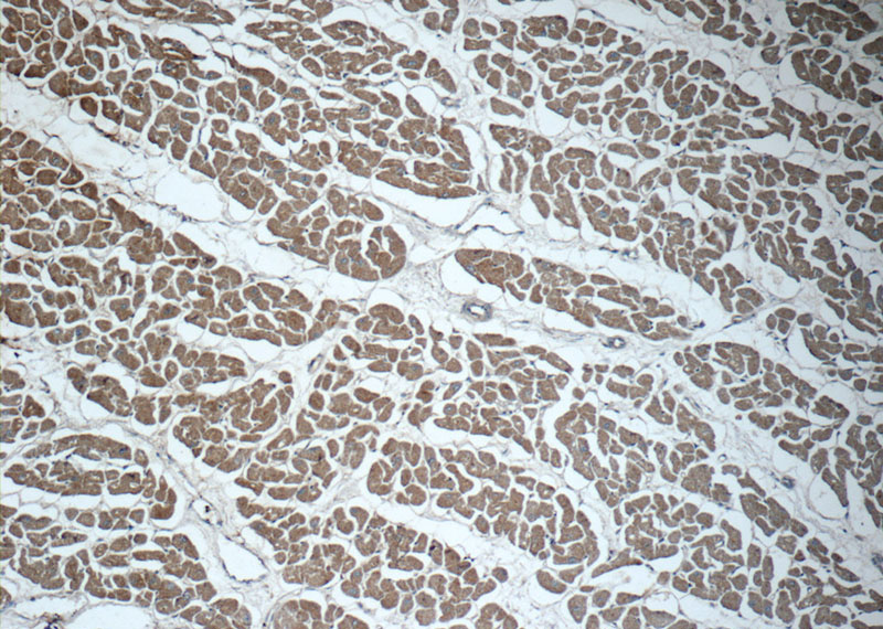 Immunohistochemistry of paraffin-embedded human heart tissue slide using Catalog No:112935(MYH6 Antibody) at dilution of 1:50 (under 10x lens)