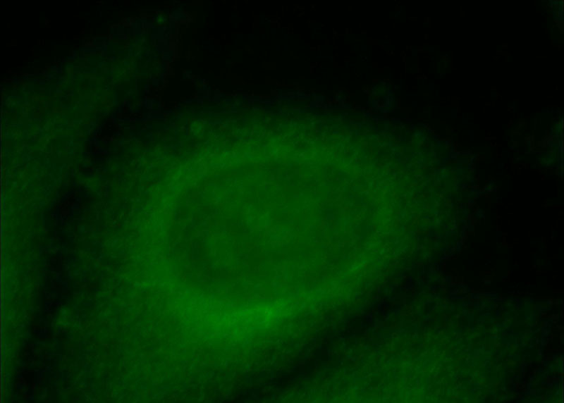 Immunofluorescent analysis of HepG2 cells, using PPPDE1 antibody Catalog No:114156 at 1:25 dilution and FITC- labeled goat anti-Rabbit IgG (green).