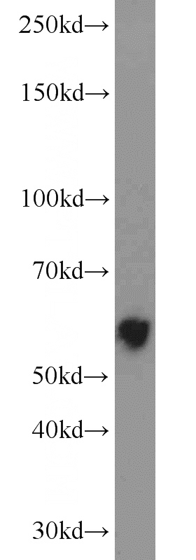 human lung tissue were subjected to SDS PAGE followed by western blot with Catalog No:112300(LPCAT1 antibody) at dilution of 1:4000