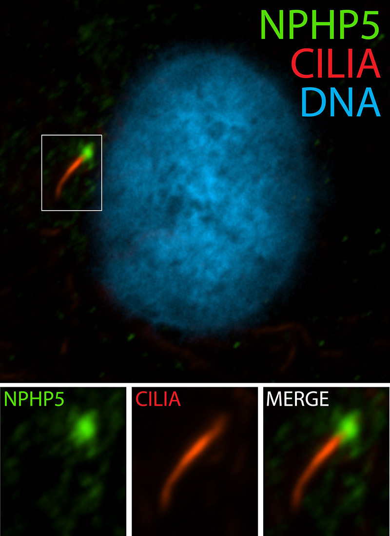 IF Result of anti-NPHP5 (Catalog No:113215) show the base of cilia in human hTERT-RPE1 cells by Dr. Moshe Kim.