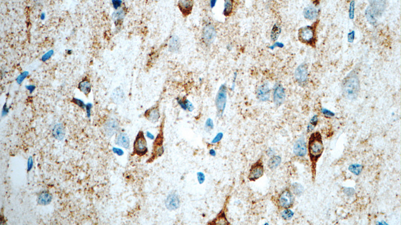 Immunohistochemistry of paraffin-embedded human brain tissue slide using Catalog No:112058(KCNJ2 Antibody) at dilution of 1:50