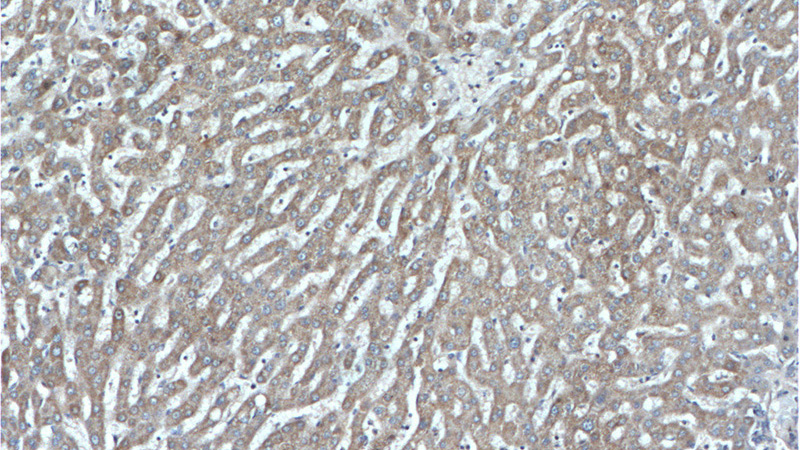 Immunohistochemistry of paraffin-embedded human liver tissue slide using Catalog No:113942(PLG Antibody) at dilution of 1:200 (under 10x lens).