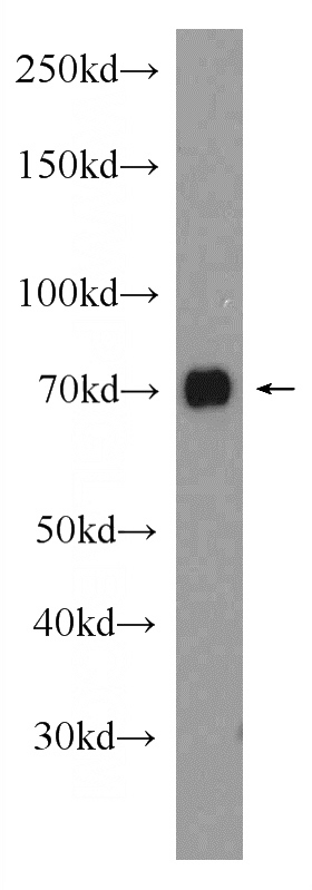 HeLa cells were subjected to SDS PAGE followed by western blot with Catalog No:113265(NR2C2 Antibody) at dilution of 1:1500