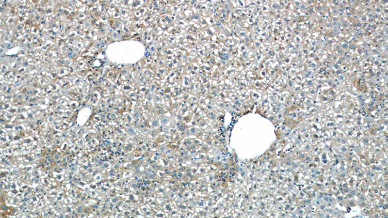 Immunohistochemical of paraffin-embedded mouse liver using Catalog No:112396(L-VocC antibody) at dilution of 1:50 (under 10x lens)