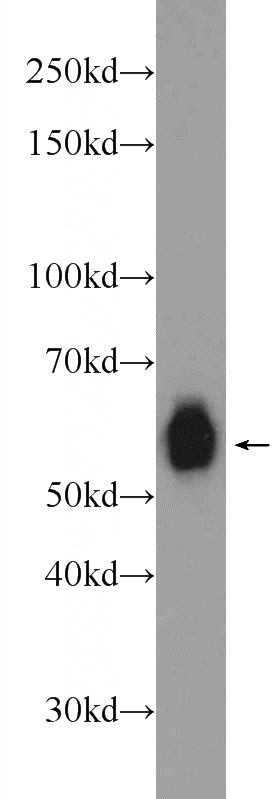 Jurkat cells were subjected to SDS PAGE followed by western blot with Catalog No:114580(RCOR2 Antibody) at dilution of 1:1000