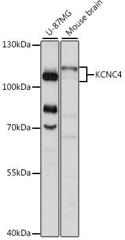 Western blot - KCNC4 Polyclonal Antibody 
