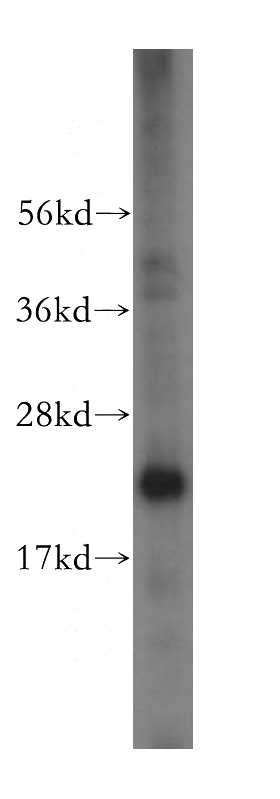 HeLa cells were subjected to SDS PAGE followed by western blot with Catalog No:110261(EIF4E3 antibody) at dilution of 1:500