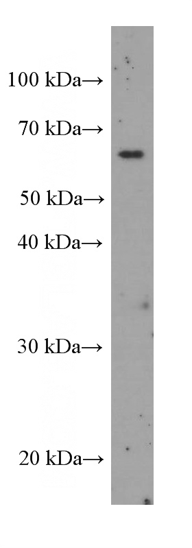 Y79 cells were subjected to SDS PAGE followed by western blot with Catalog No:107085(BEST1 Antibody) at dilution of 1:1000