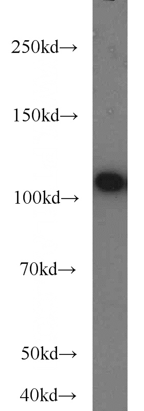 HeLa cells were subjected to SDS PAGE followed by western blot with Catalog No:110799(FUT4 antibody) at dilution of 1:500