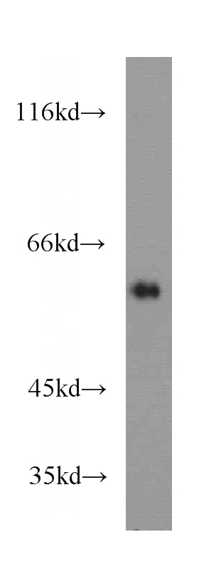 COS-7 cells were subjected to SDS PAGE followed by western blot with Catalog No:108861(CARM1 antibody) at dilution of 1:500