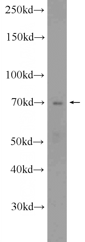 3T3-L1 cells were subjected to SDS PAGE followed by western blot with Catalog No:110167(EBF1 Antibody) at dilution of 1:300