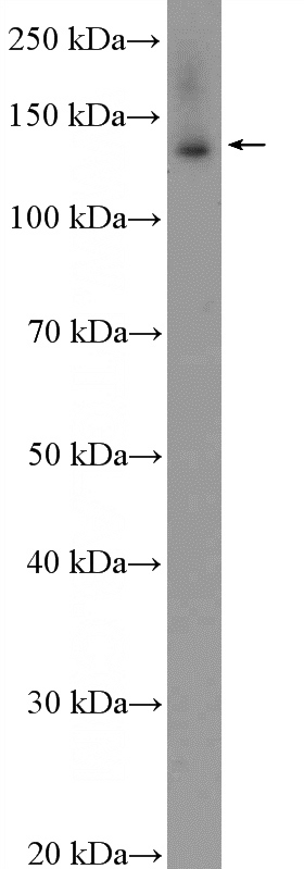 HeLa cells were subjected to SDS PAGE followed by western blot with Catalog No:117207(BNC2 Antibody) at dilution of 1:600