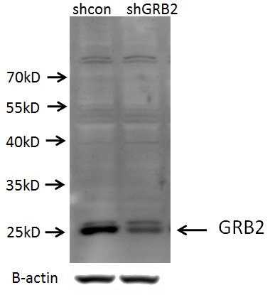 C2C12 cells (shcontrol and shRNA of GRB2) were subjected to SDS PAGE followed by western blot with Catalog No:111200(GRB2 antibody) at dilution of 1:1000. (Data provided by Angran Biotech (www.miRNAlab.com)).