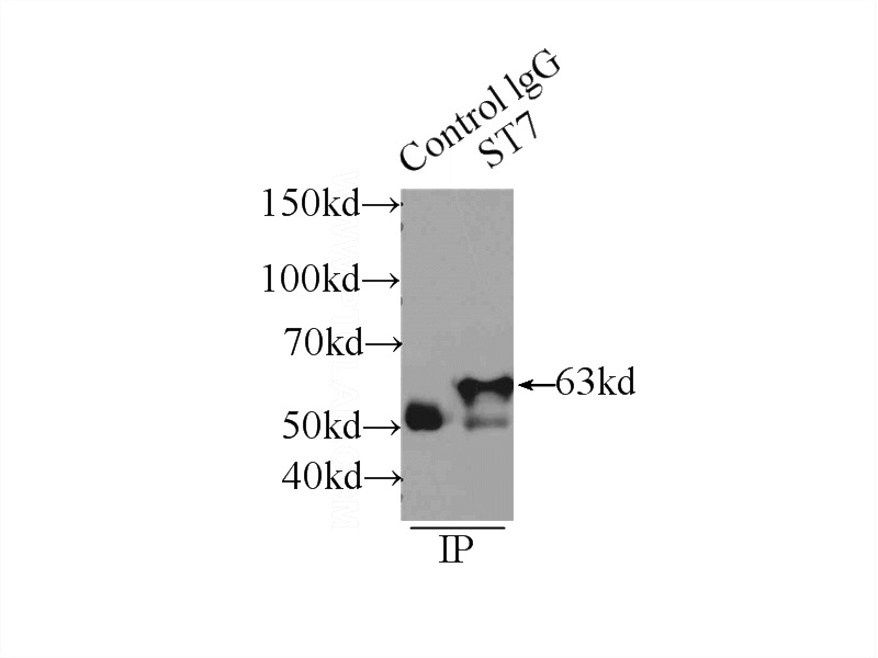 IP Result of anti-ST7 (IP:Catalog No:115631, 4ug; Detection:Catalog No:115631 1:1500) with PC-3 cells lysate 2640ug.