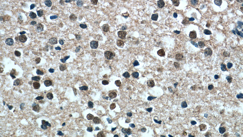 Immunohistochemistry of paraffin-embedded human brain tissue slide using Catalog No:107238(DEK Antibody) at dilution of 1:50 (under 40x lens)