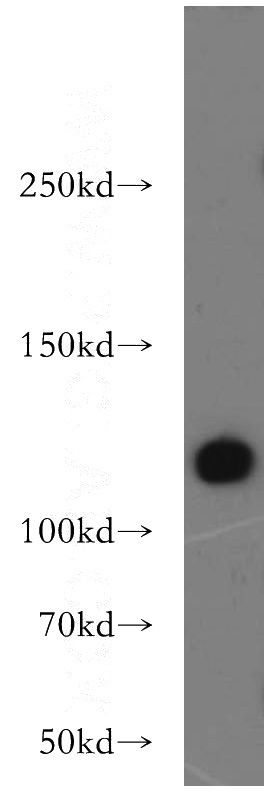 L02 cells were subjected to SDS PAGE followed by western blot with Catalog No:111698(HSPA4 antibody) at dilution of 1:500