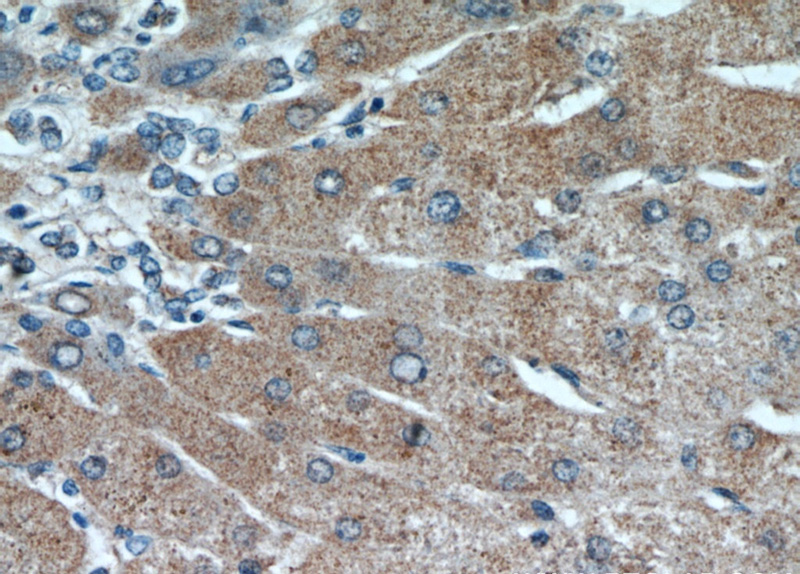 Immunohistochemical of paraffin-embedded human hepatocirrhosis using Catalog No:114537(RANBP10 antibody) at dilution of 1:50 (under 40x lens)