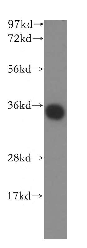 human liver tissue were subjected to SDS PAGE followed by western blot with Catalog No:116339(TRAPA, SSR1 antibody) at dilution of 1:250