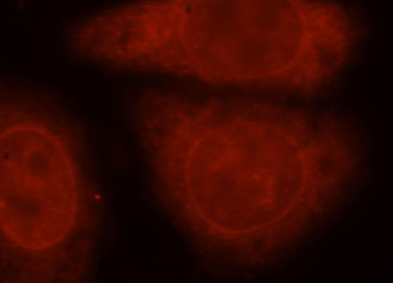 Immunofluorescent analysis of HepG2 cells, using Catalog No:116116 and Rhodamine-labeled goat anti-rabbit IgG (red).