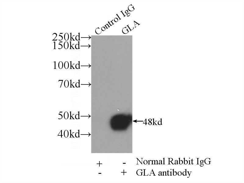 IP Result of anti-GLA (IP:Catalog No:107870, 3ug; Detection:Catalog No:107870 1:1000) with HEK-293 cells lysate 1800ug.