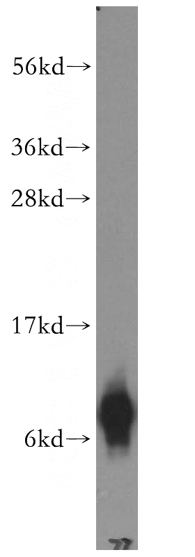 COLO 320 cells were subjected to SDS PAGE followed by western blot with Catalog No:110755(FXYD3 antibody) at dilution of 1:400