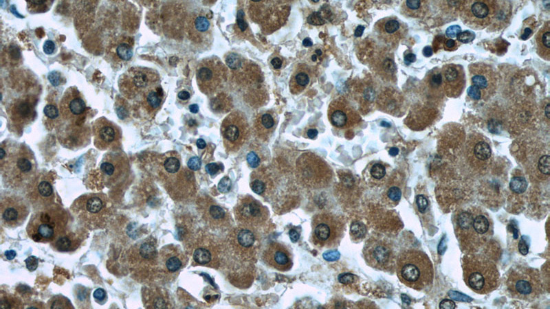 Immunohistochemistry of paraffin-embedded human liver tissue slide using Catalog No:107461(PDHA1 Antibody) at dilution of 1:50(under 40x lens)