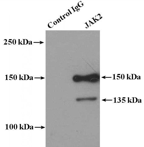 IP Result of anti-JAK2 (IP:Catalog No:111879, 4ug; Detection:Catalog No:111879 1:300) with Jurkat cells lysate 3800ug.