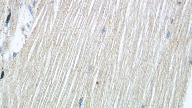 Immunohistochemistry of paraffin-embedded human skeletal muscle tissue slide using Catalog No:115007(SCN4B Antibody) at dilution of 1:50 (under 40x lens)