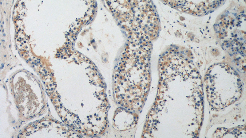Immunohistochemistry of paraffin-embedded human testis tissue slide using Catalog No:108318(ATP9A Antibody) at dilution of 1:200 (under 10x lens).