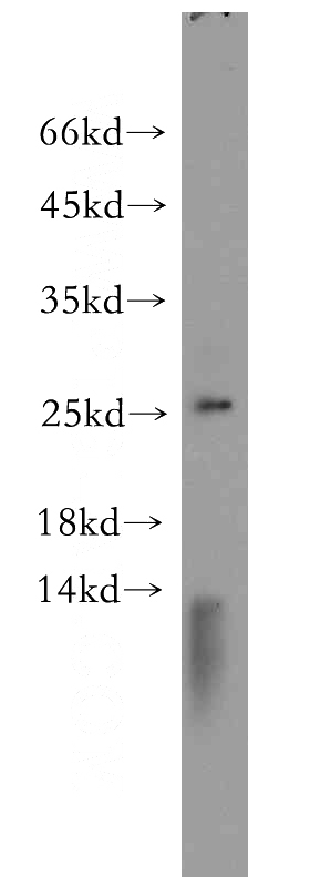 A431 cells were subjected to SDS PAGE followed by western blot with Catalog No:108868(CSNK2B-Specific antibody) at dilution of 1:100