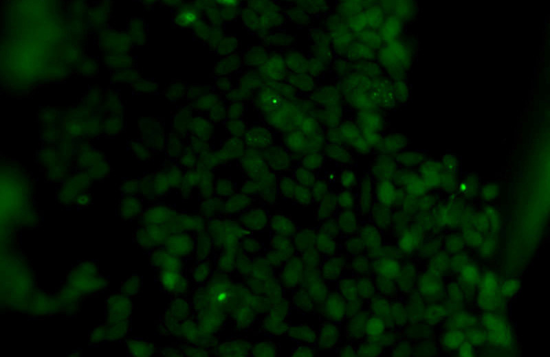 Immunofluorescent analysis of HEK-293 cells using Catalog No:115838(SUMO2/3 Antibody) at dilution of 1:50 and Alexa Fluor 488-congugated AffiniPure Goat Anti-Rabbit IgG(H+L)