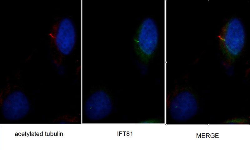 Immunofluorescent images of MDCK cells stained with IFT81 rabbit pAb (Catalog No:111673) and acetylated tubulin mouse mAb (Catalog No:107557) at dilution of 1:50, further stained with Alexa Fluor 488-congugated AffiniPure Goat Anti-Rabbit IgG(H+L) for IFT81, and Rhodamine-Goat anti-rabbit IgG for Catalog No:107557.