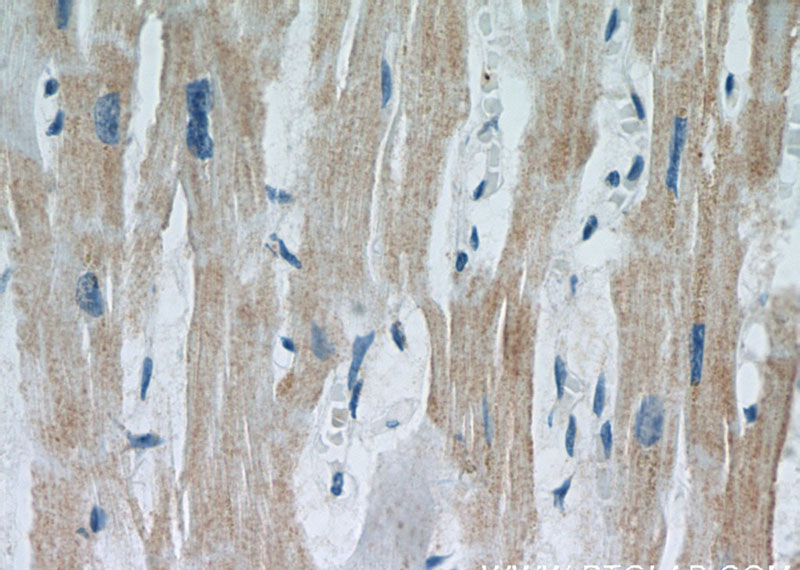 Immunohistochemical of paraffin-embedded human heart using Catalog No:112647(MAP2K5 antibody) at dilution of 1:50 (under 40x lens)