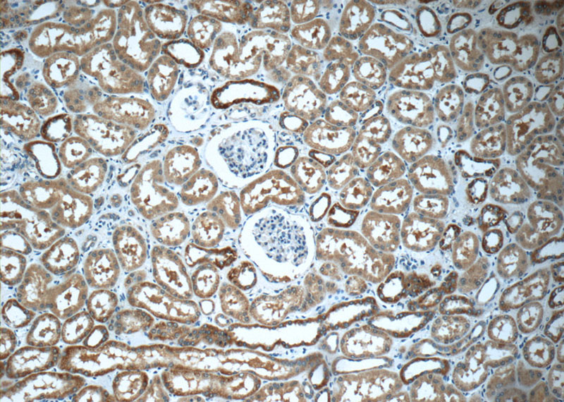 Immunohistochemistry of paraffin-embedded human kidney tissue slide using Catalog No:114433(RAB34 Antibody) at dilution of 1:50 (under 10x lens)