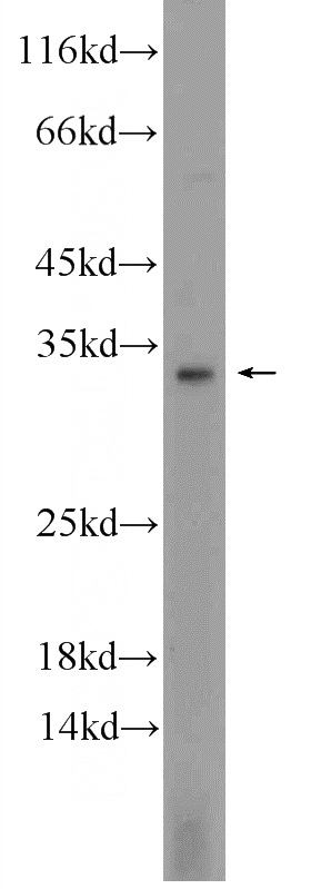 MCF-7 cells were subjected to SDS PAGE followed by western blot with Catalog No:108891(CTSG Antibody) at dilution of 1:600