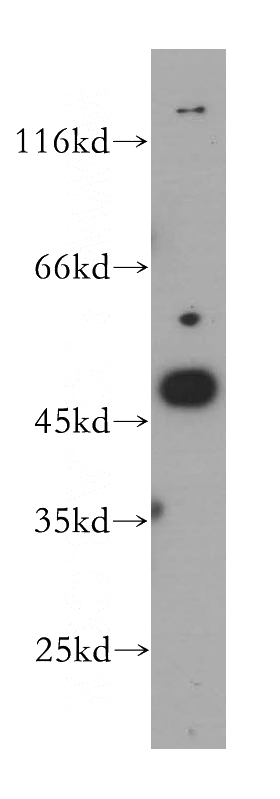 A375 cells were subjected to SDS PAGE followed by western blot with Catalog No:112379(MAGEA11 antibody) at dilution of 1:200