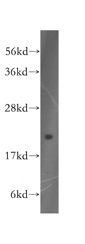 HEK-293 cells were subjected to SDS PAGE followed by western blot with Catalog No:110120(DUSP22 antibody) at dilution of 1:400