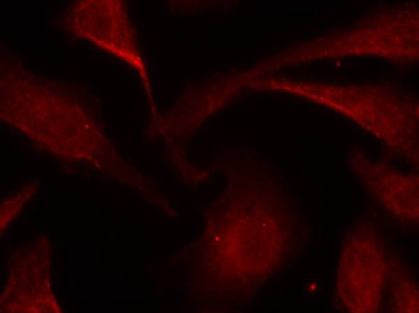 Immunofluorescence staining of methanol-fixed Hela cells using NFu03baB-p65 (Phospho-Ser529) Antibody .