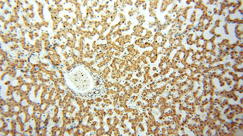 Immunohistochemical of paraffin-embedded human liver using Catalog No:108111(ANXA9 antibody) at dilution of 1:50 (under 10x lens)