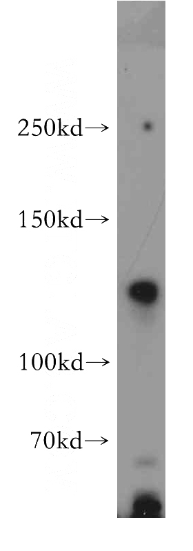 HEK-293 cells were subjected to SDS PAGE followed by western blot with Catalog No:113274(NRCAM antibody) at dilution of 1:500