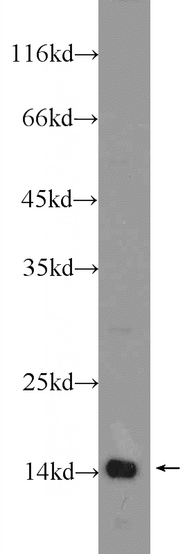mouse testis tissue were subjected to SDS PAGE followed by western blot with Catalog No:115979(TAF13 Antibody) at dilution of 1:600