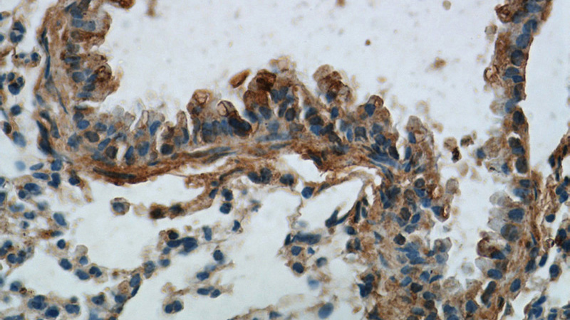 Immunohistochemistry of paraffin-embedded mouse lung tissue slide using Catalog No:114015(PLUNC Antibody) at dilution of 1:100 (under 40x lens).
