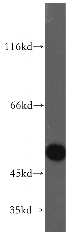 Jurkat cells were subjected to SDS PAGE followed by western blot with Catalog No:110495(EVL antibody) at dilution of 1:200