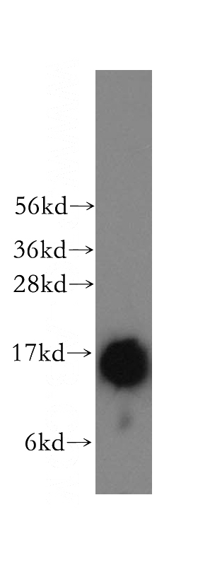 human brain tissue were subjected to SDS PAGE followed by western blot with Catalog No:116342(TRAPPC2 antibody) at dilution of 1:600