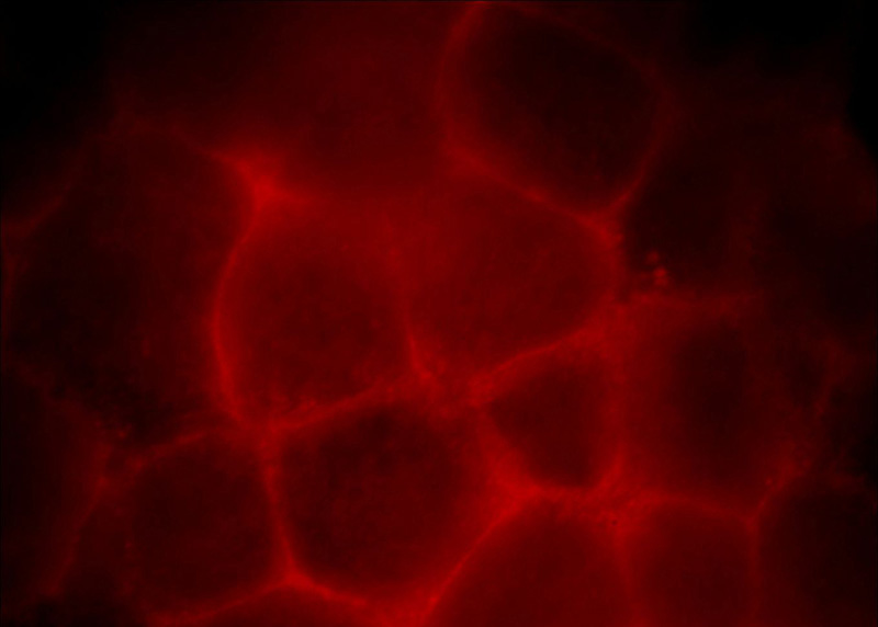 Immunofluorescent analysis of Hela cells, using ZDHHC5 antibody Catalog No:117034 at 1:25 dilution and Rhodamine-labeled goat anti-rabbit IgG (red).